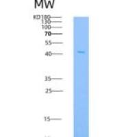 小鼠MEK1 / MAP2K1 / MKK1重组蛋白