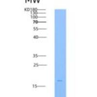 人TRAIL R4 / CD264 / TNFRSF10D重组蛋白His tag