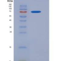 人FGFR1 / CD331重组蛋白His & GST tag