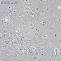 Th2细胞因子抑制剂(Suplatast Tosilate)