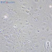 Th2细胞因子抑制剂（Suplatast Tosilate）