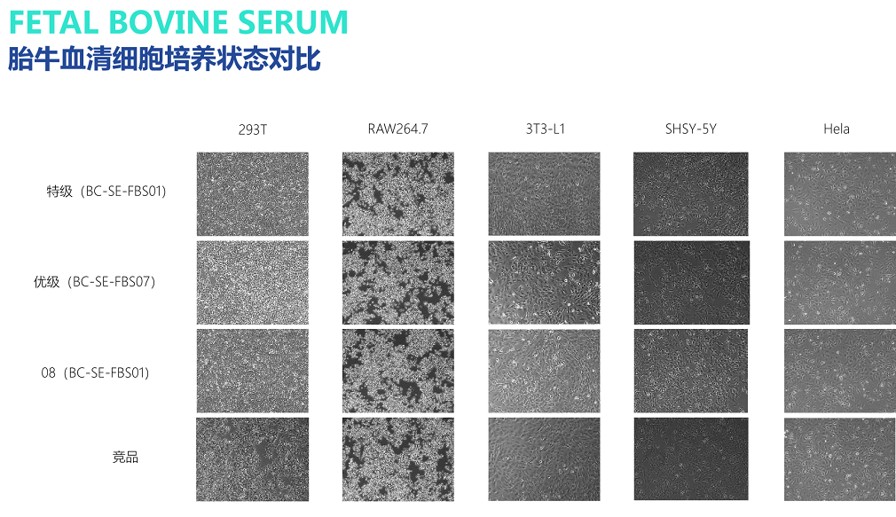 优级胎牛血清 Fetal Bovine Serum（Char