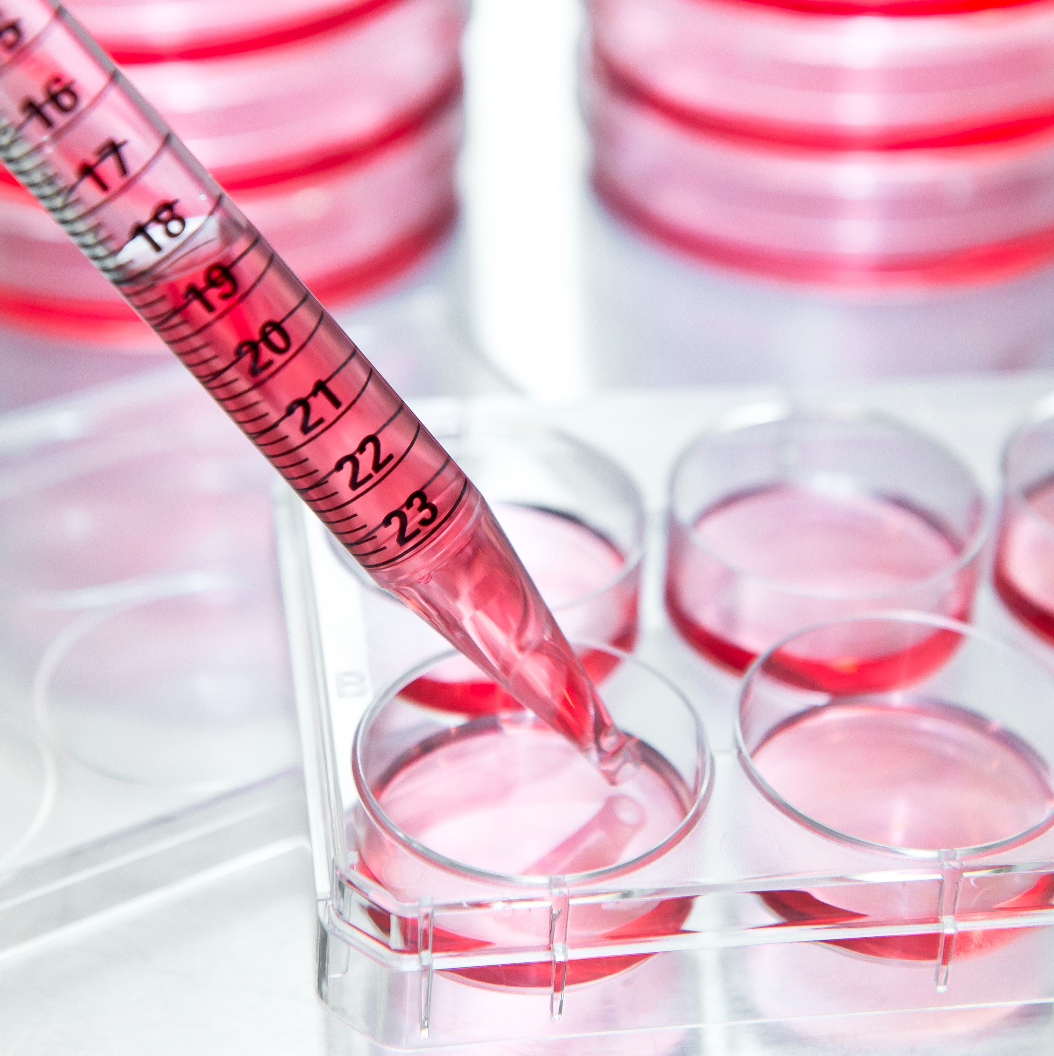 外泌体提取纯化试剂盒（多合一）