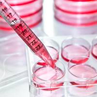 外泌体提取纯化试剂盒（多合一）