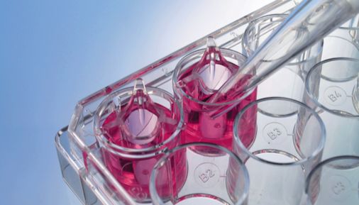 THINCERT®细胞培养小室的应用