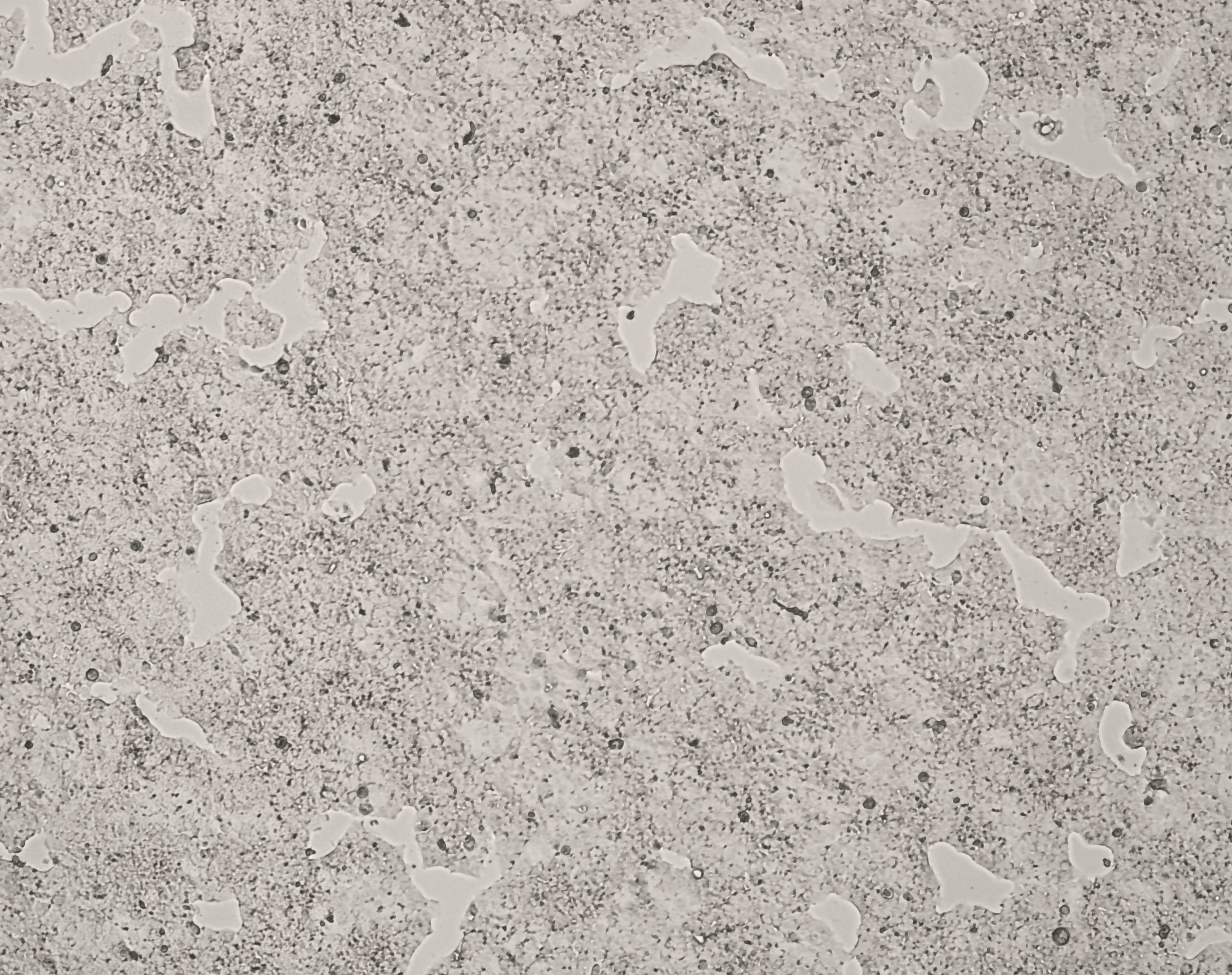 细胞攻略 | NCI-H2170(人肺鳞癌细胞)培养教程