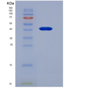 小鼠抵抗素样蛋白β(RETNLb)重组蛋白