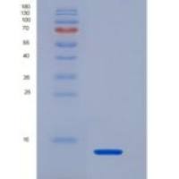 人不均一核糖核蛋白A2/B1(HNRPA2B1)重组蛋白