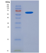 小鼠激肽释放酶6(KLK6)重组蛋白