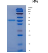 人纤维蛋白原相关蛋白1(FGL1)重组蛋白