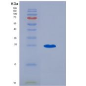 小鼠血小板反应蛋白(THBS1)重组蛋白