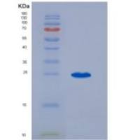 小鼠血小板反应蛋白(THBS1)重组蛋白