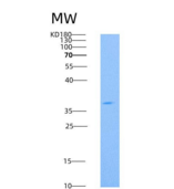 人CD73 / NT5E重组蛋白His tag
