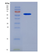 小鼠轴突生长诱向因子1(Ntn1)重组蛋白