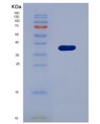 人干扰素诱导蛋白35(IFI35)重组蛋白