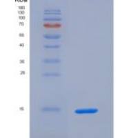 大鼠S100钙结合蛋白A9(S100A9)重组蛋白