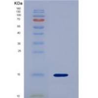 人嘌呤能受体P2Y14(P2RY14)重组蛋白