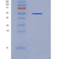 人内皮细胞TEK酪氨酸激酶(Tie2)重组蛋白