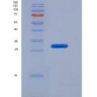 人肌动蛋白β(ACTB)重组蛋白
