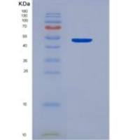 人表面活性物质关联蛋白A(SFTPA1)重组蛋白
