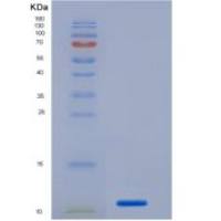 人血小板内皮细胞粘附分子1(PECAM1)重组蛋白