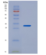 小鼠核因子κB受体激活因子(RANk)重组蛋白