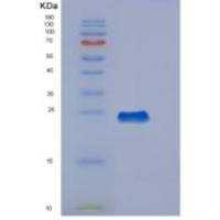 人血栓调节蛋白(TM)重组蛋白
