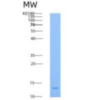 人Ig和ITIM域蛋白T-细胞免疫受体(TIGIT)重组蛋白His Tag