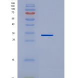 人纤溶酶原(Plg)重组蛋白