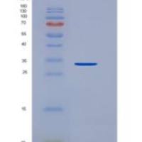 人纤溶酶原(Plg)重组蛋白