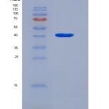 人视紫质(RHO)重组蛋白