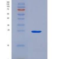 人谷氨酸半胱氨酸连接酶催化亚基(GCLC)重组蛋白