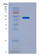 小鼠Mdm2 p53结合蛋白同源物(MDM2)重组蛋白