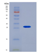 人激肽释放酶4(KLK4)重组蛋白