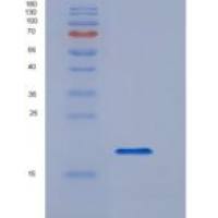 人血管性血友病因子(vWF)重组蛋白
