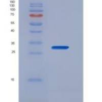 小鼠核因子κB受体激活因子(RANk)重组蛋白