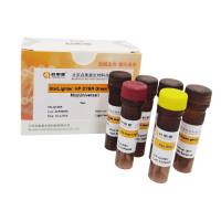 StarLighter 高性能染料法 qPCR 预混液 (通用型)