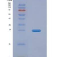 大鼠成纤维细胞生长因子21(FGF21)重组蛋白