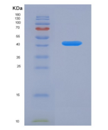 人VGF神经生长因子诱导蛋白(VGF)重组蛋白