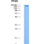 人AMPK (G1/B2/A2) Heterotrimer重组蛋白