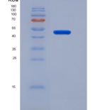 小鼠Mdm2 p53结合蛋白同源物(MDM2)重组蛋白