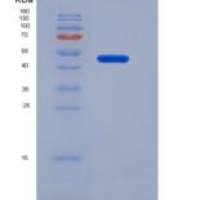 小鼠Mdm2 p53结合蛋白同源物(MDM2)重组蛋白