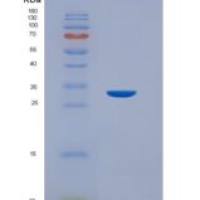 人Ⅶ型胶原(COL7)重组蛋白