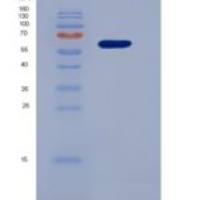 人血管紧张素转化酶(ACE)重组蛋白