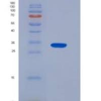 人组织因子(TF)重组蛋白