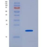 人细胞色素C氧化酶亚基Ⅱ(COX2)重组蛋白
