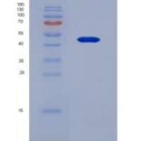 人脂多糖结合蛋白(LBP)重组蛋白