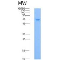 人多巴脱羧酶/ DDC重组蛋白His tag