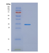 小鼠γ-谷氨酰转移酶1(gGT1)重组蛋白