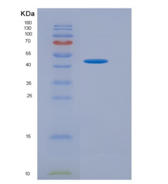 人γ-氨基丁酸B受体1(gABBR1)重组蛋白